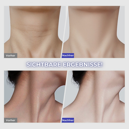 Sonado hautstraffende Halscreme - 2 für 1 💜